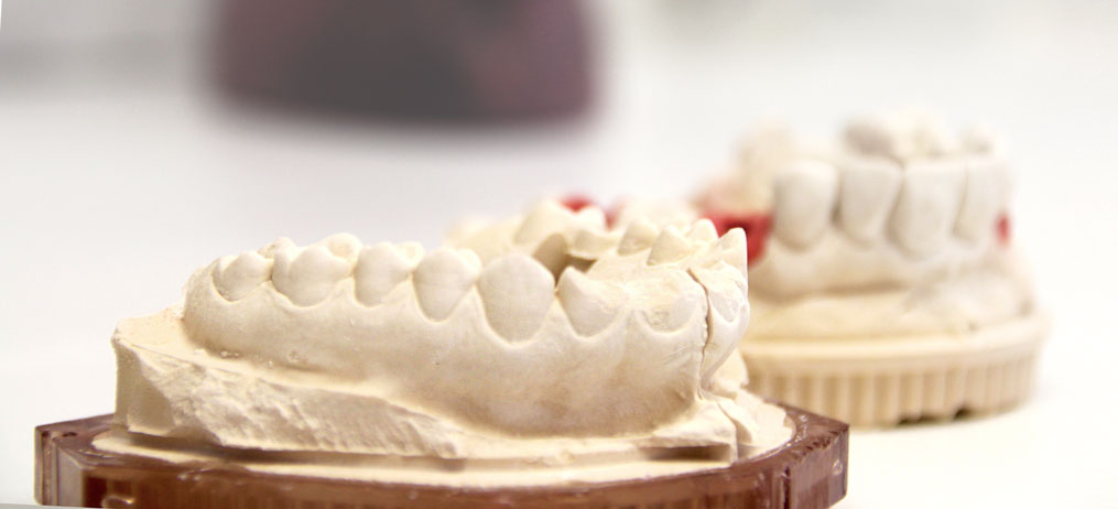 Bild Zahnlabor der Zahnarztpraxis Alda in Niederkassel, Implantologie, Parodontologie